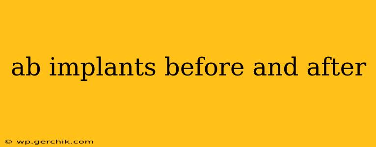 ab implants before and after