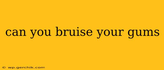 can you bruise your gums