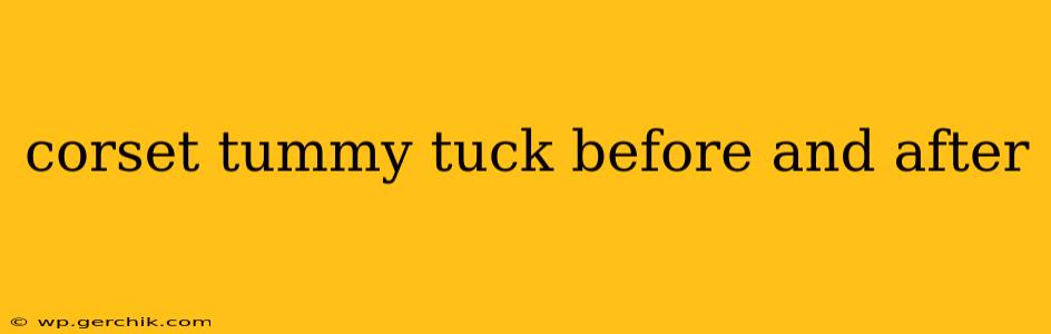 corset tummy tuck before and after