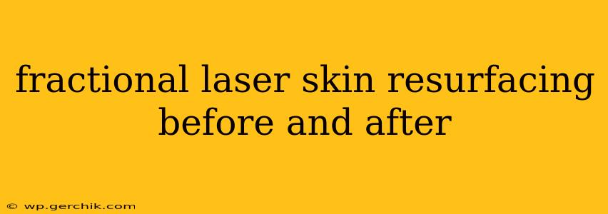 fractional laser skin resurfacing before and after