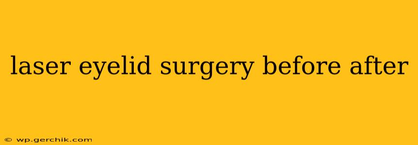 laser eyelid surgery before after
