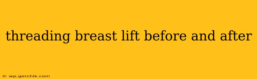 threading breast lift before and after