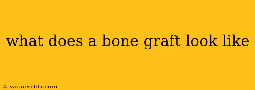 what does a bone graft look like